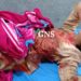 Poonch girl injured in Pak army fire while grazing goats near LoC: Officials