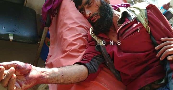 Anantnag duo sustain critical injuries in bear attack