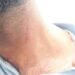 Doctor Allegedly Slaps Attendant In Kunzer, BMO Assures Action