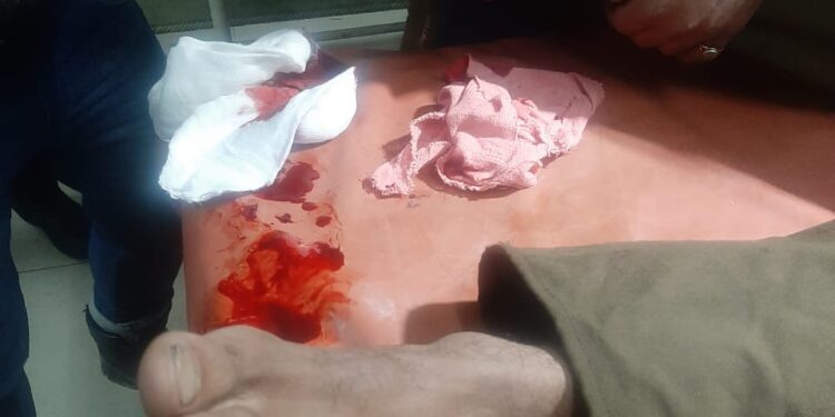 Army porter injured in landmine blast in Kupwara