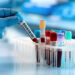 Sample-collector Apprehended Over Charges of ‘Destroying Blood Samples, Embezzlement’ in Pattan