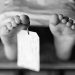 Minor Girl Injured In Canine Attack In Budgam Last Month Succumbs At GB Panth Hospital