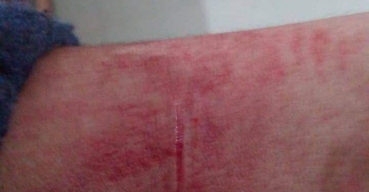 NC MPs condemn attack on Kashmiri students in Punjab