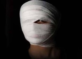 Srinagar Acid: Police Files 1000-Page Chargesheet Against 3 Accused