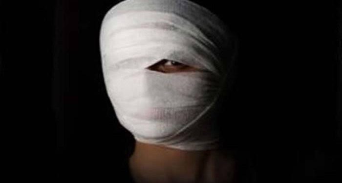 Srinagar Acid: Police Files 1000-Page Chargesheet Against 3 Accused