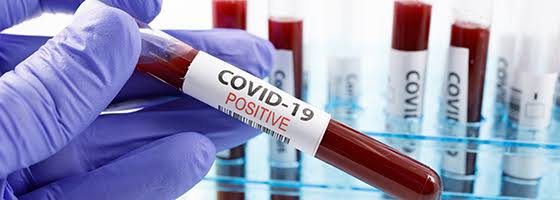 24 Students At NIT Srinagar Test Covid-19 Positive