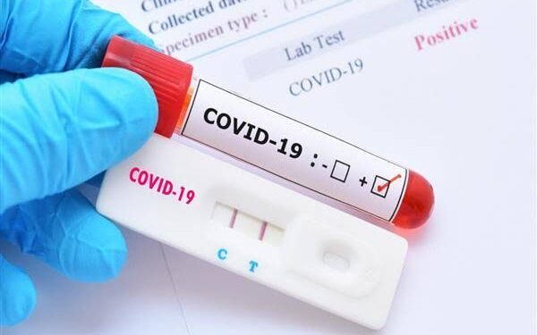 J&K reports 7 new covid-19 cases, no death