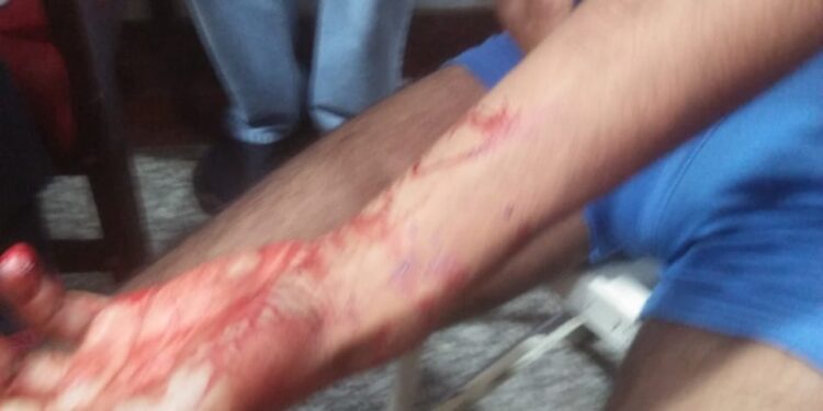 Minority Community Member Injured In Grenade Blast At Gopalpora Budgam