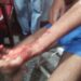 Minority Community Member Injured In Grenade Blast At Gopalpora Budgam
