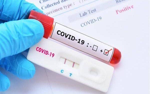 J&K Reports 586 Covid-19 Cases, No Death