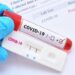 J&K Reports 586 Covid-19 Cases, No Death
