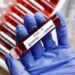 J&K Reports 273 Covid-19 Cases, 2 Deaths