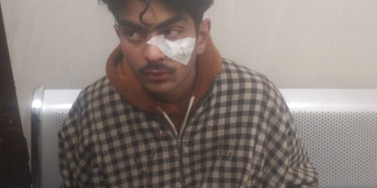 Kupwara: Teenager Shot At From 12 Bore Rifle