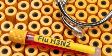 H3N2 Scare: CD Hospital Data Reveals over 100 Persons Infected with Viral Infection in Nearly One-and-a-half Month
