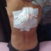 Youth Grievously Injured After Stabbed During Altercation in Sopore