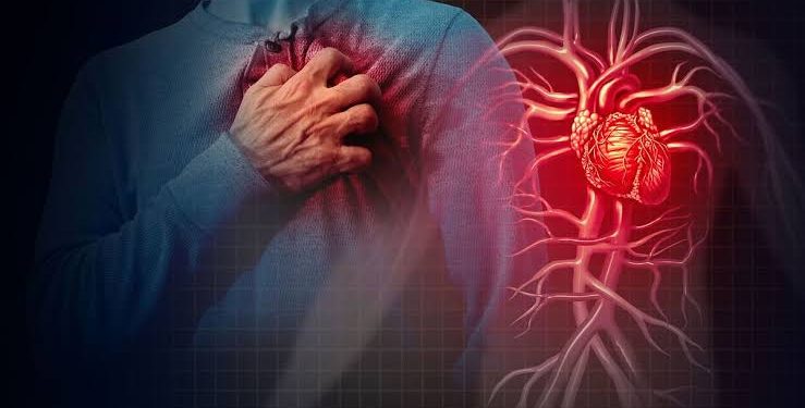 Cop Suffers Cardiac Arrest, Dies